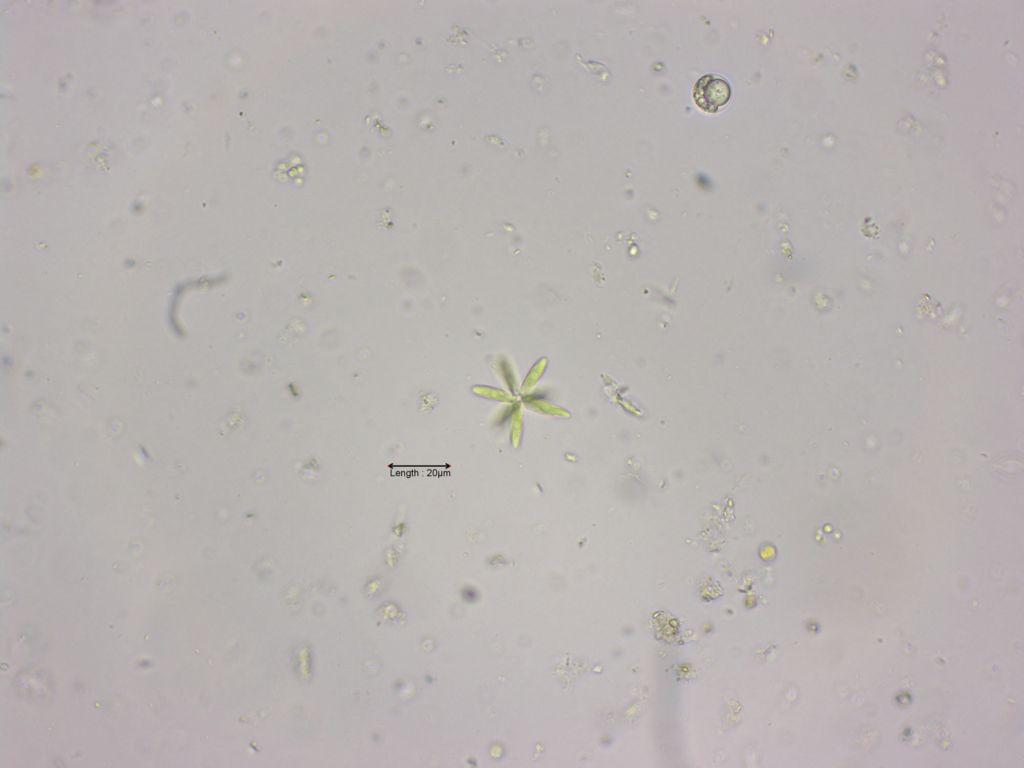 Actinastrum hantzschii