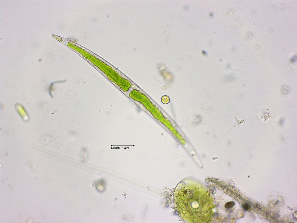 Closterium dianae