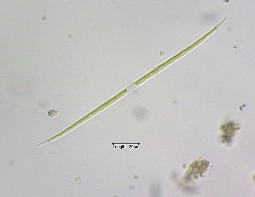 Closterium gracile