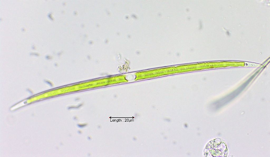 Closterium cornu