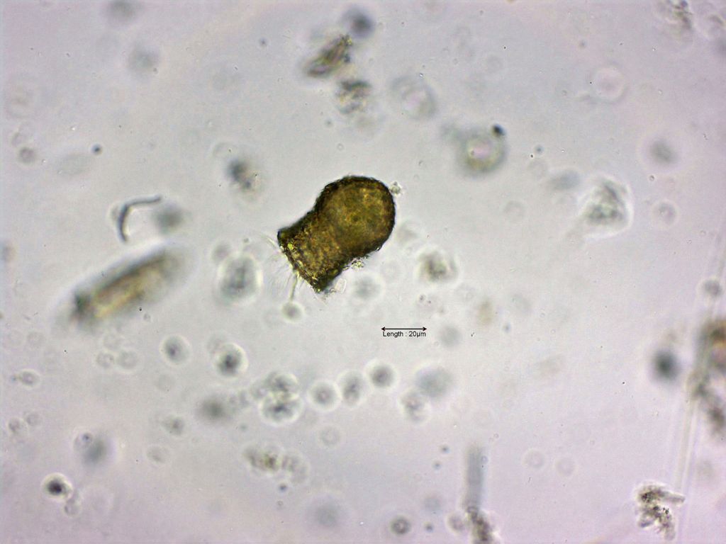 Codonella cratera 
