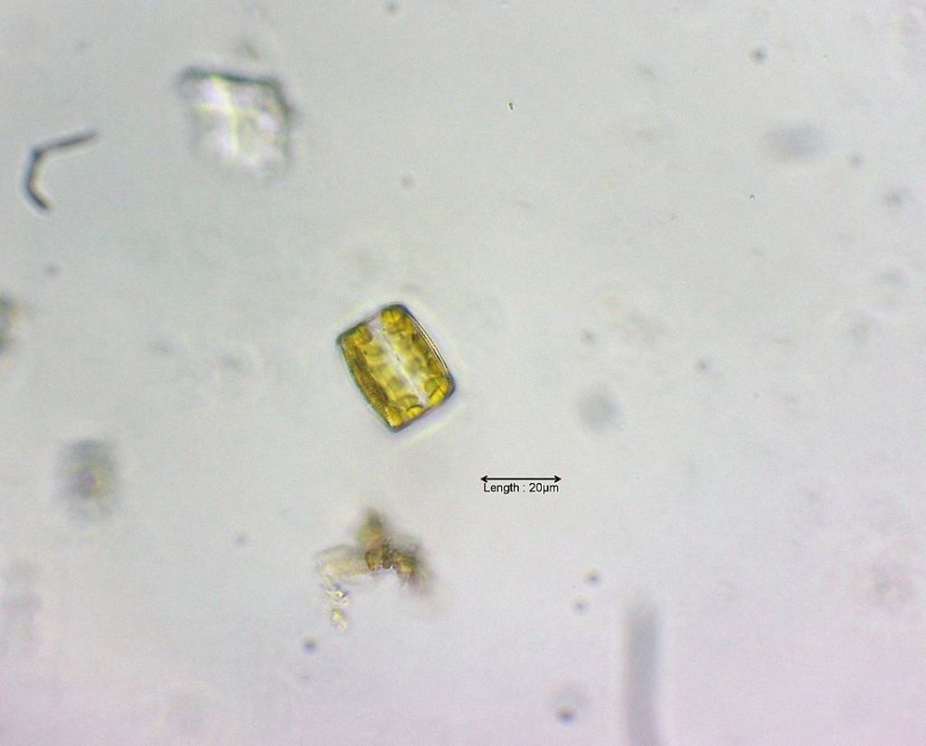Cyclotella spec girdle view