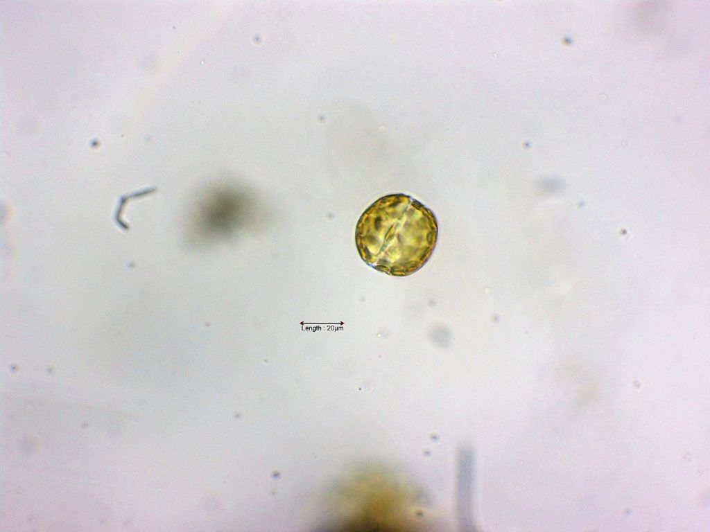 Cyclotella spec valve view