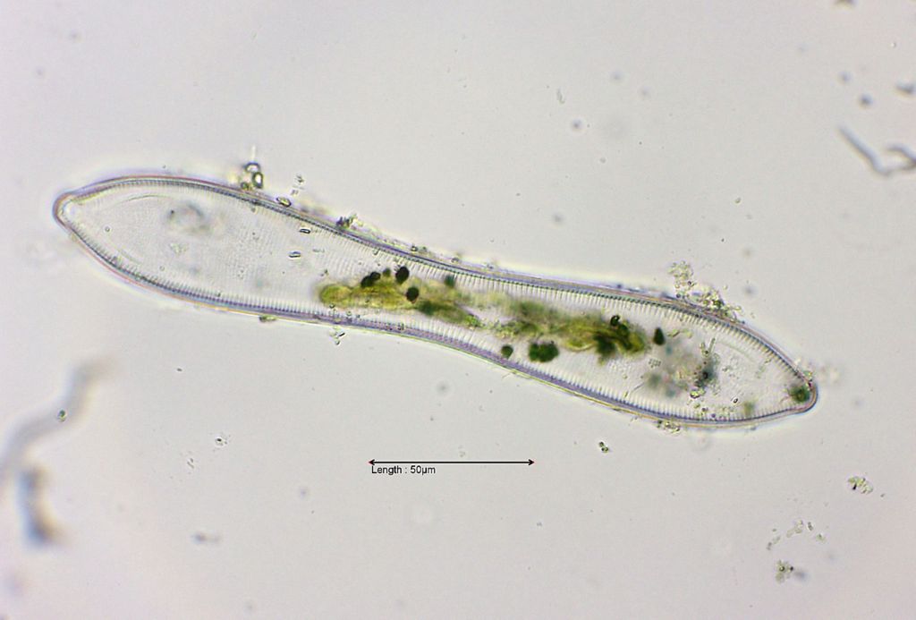 Cymatopleura solea valve view