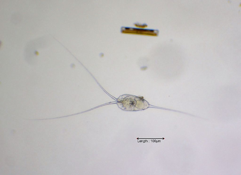 Filinia longiseta longiseta