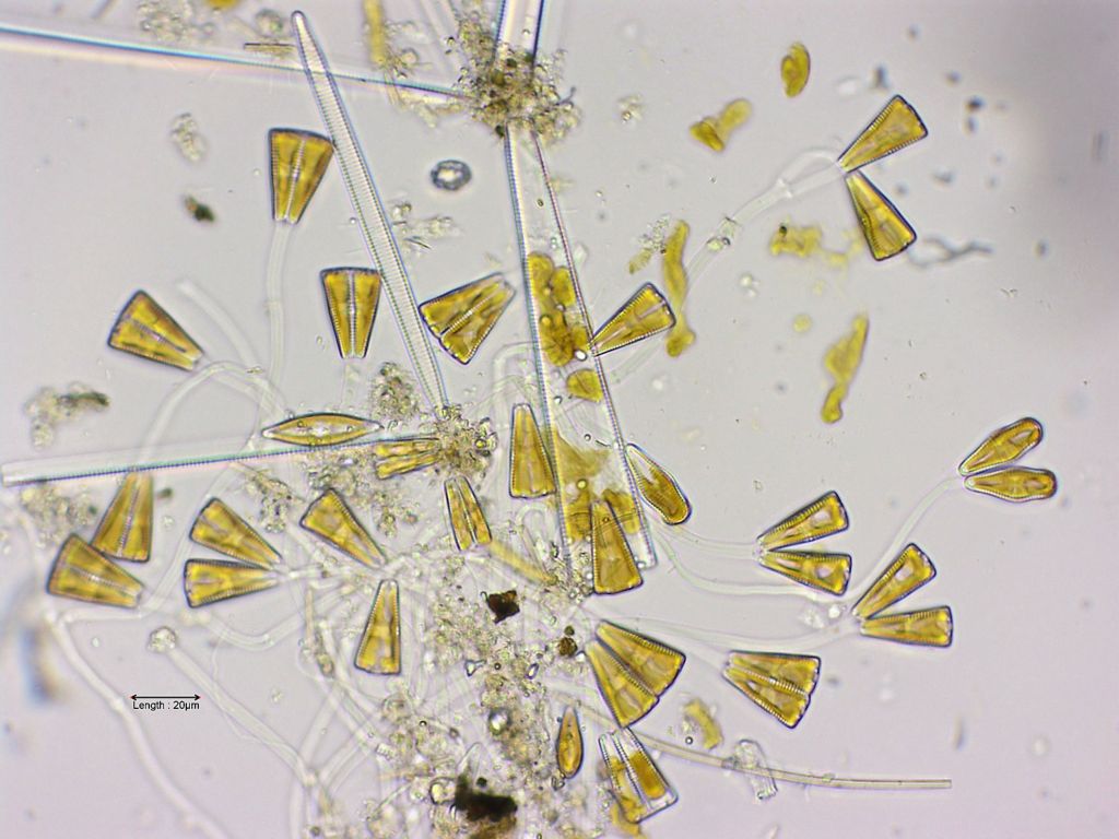 Gomphonema constrictum