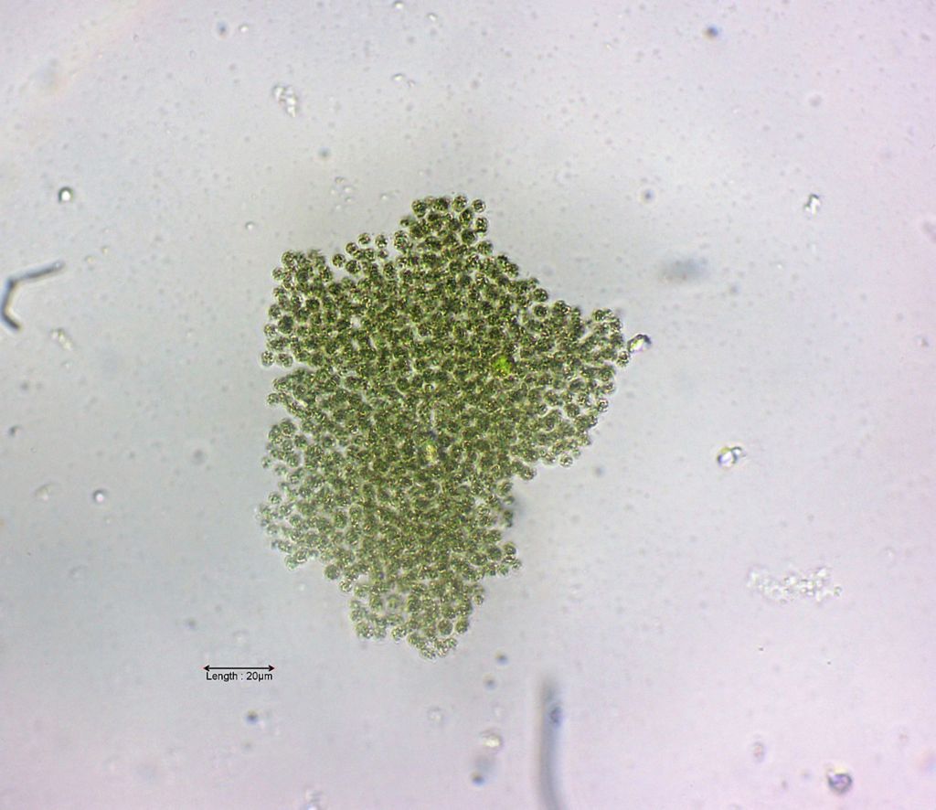 Microcystis spec 