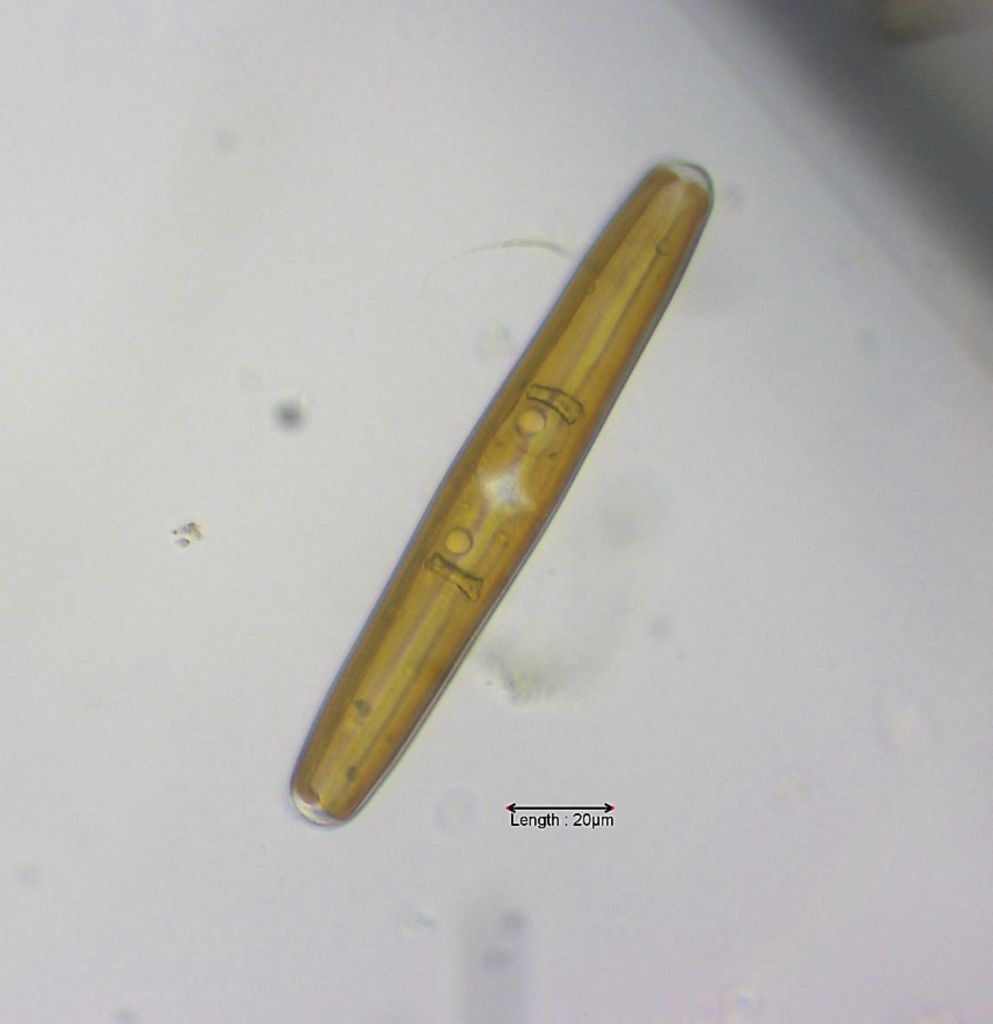 Navicula oblonga valve view