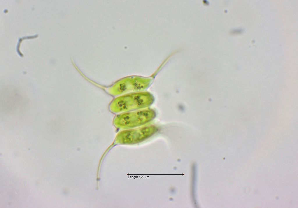Scenedesmus quadricauda