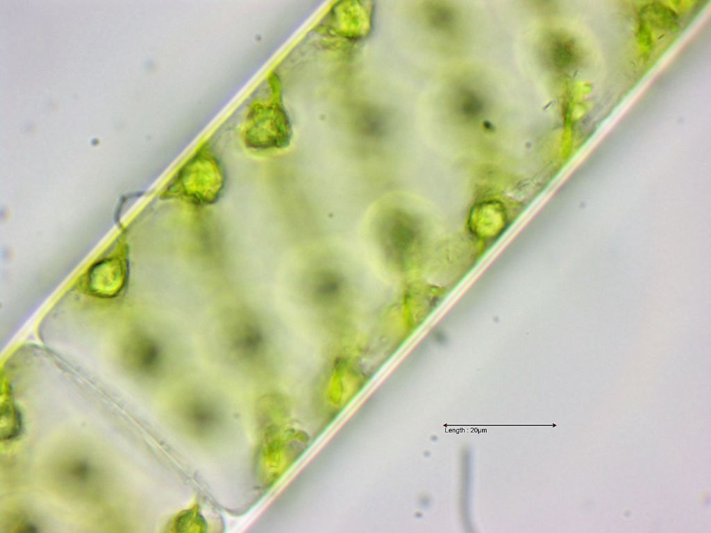 Spirogyra spec 