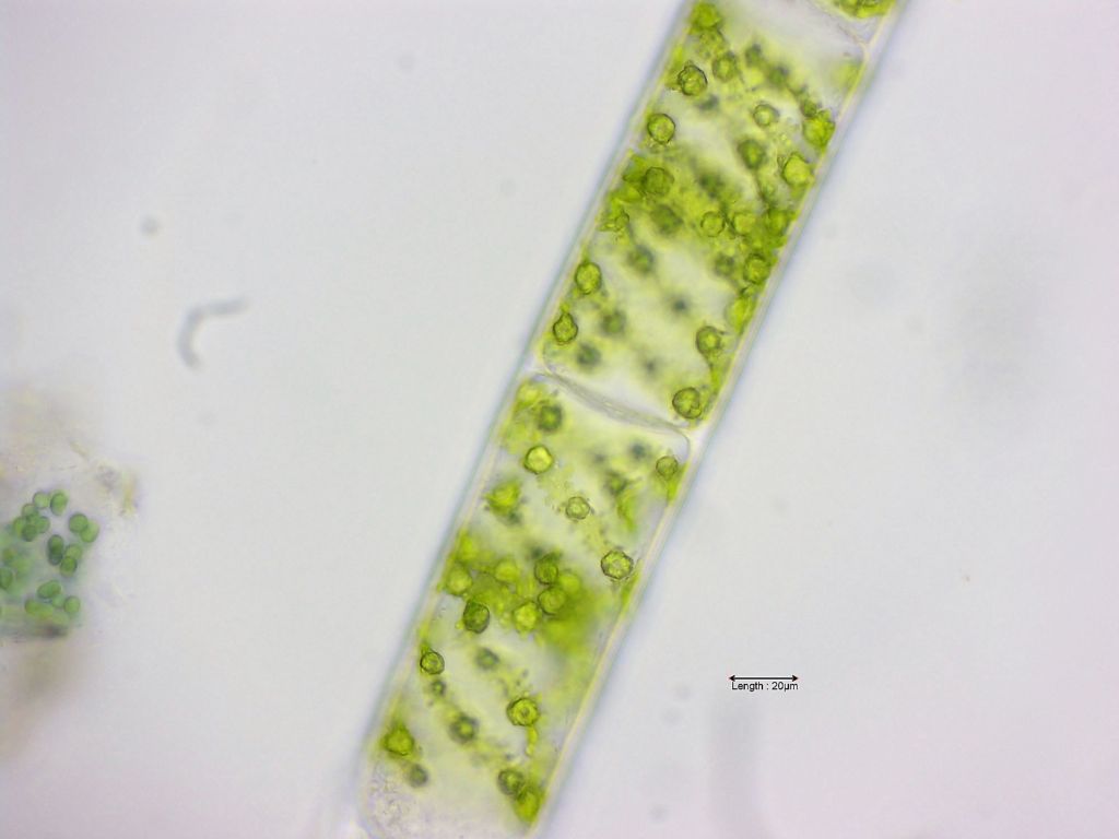 Spirogyra spec