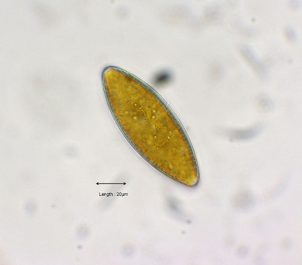 Surirella spec
