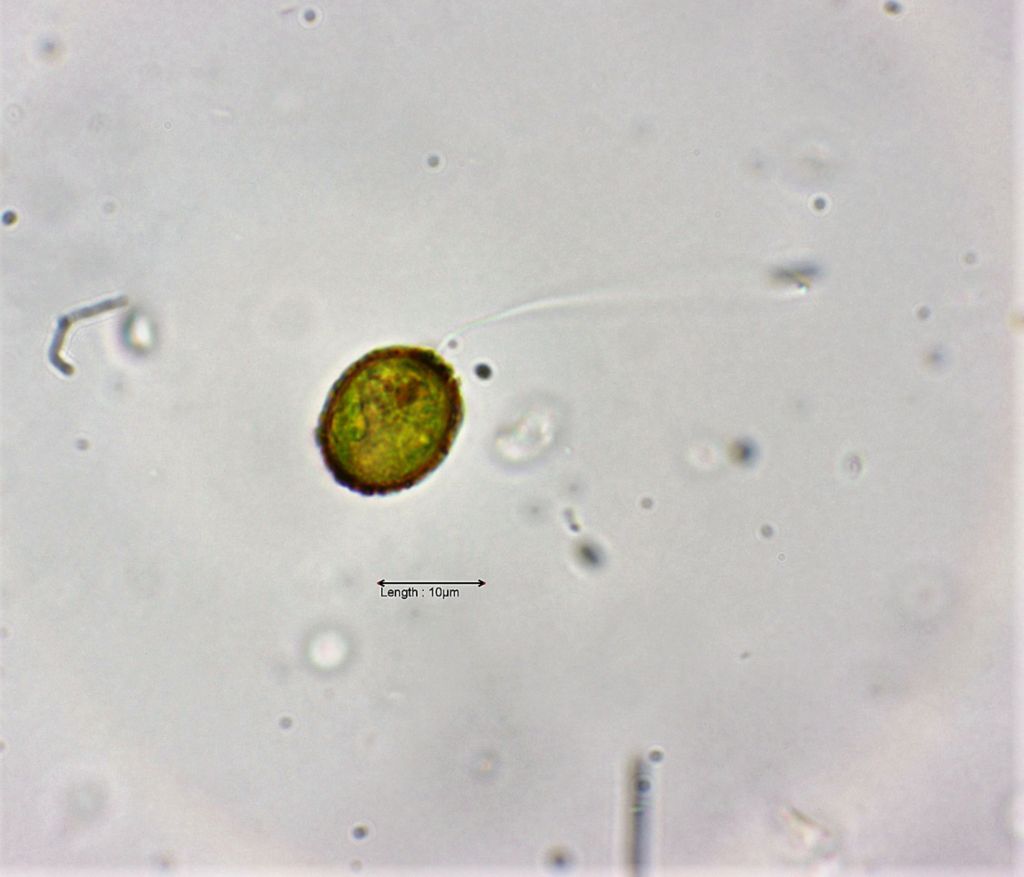 Trachelomonas hispida