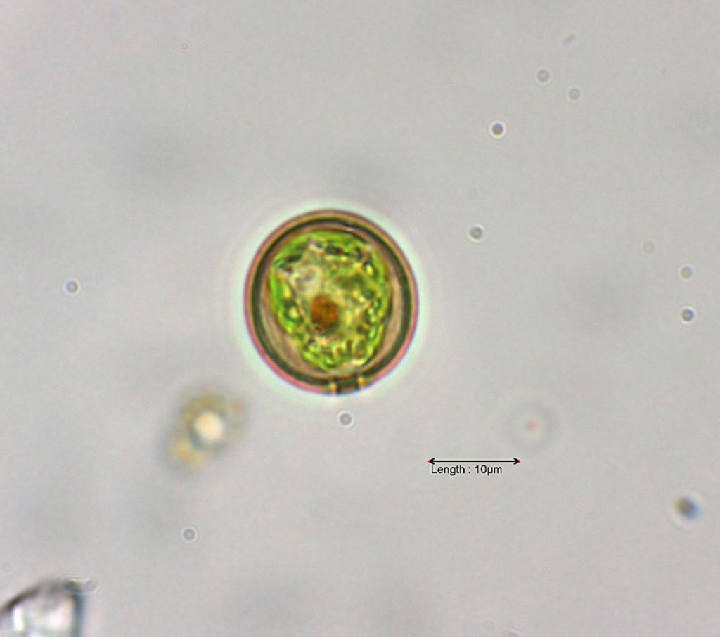 Trachelomonas volvocina