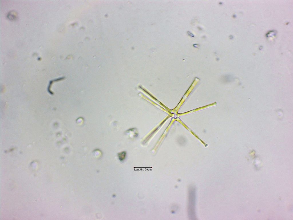 Asterionella formosa