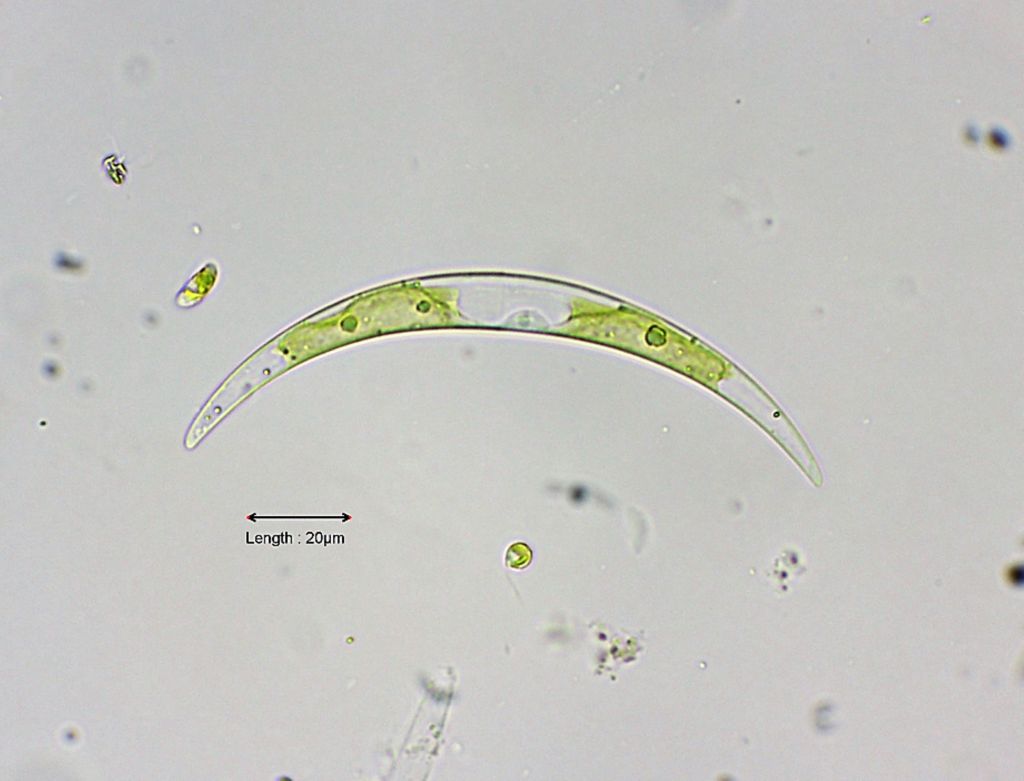 Closterium parvulum