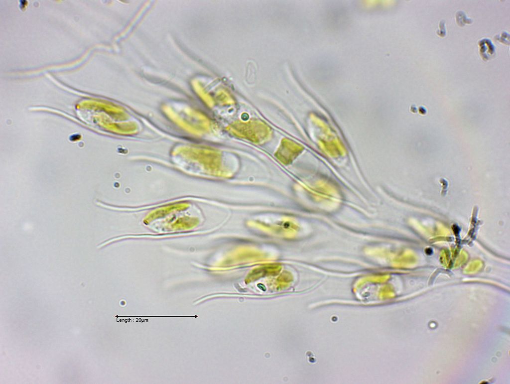 Dinobryon sertularia