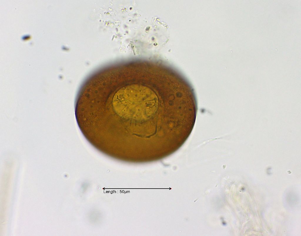 Arcella discoides