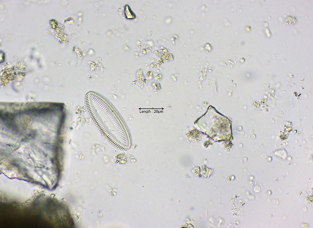 Nitzschia navicularis