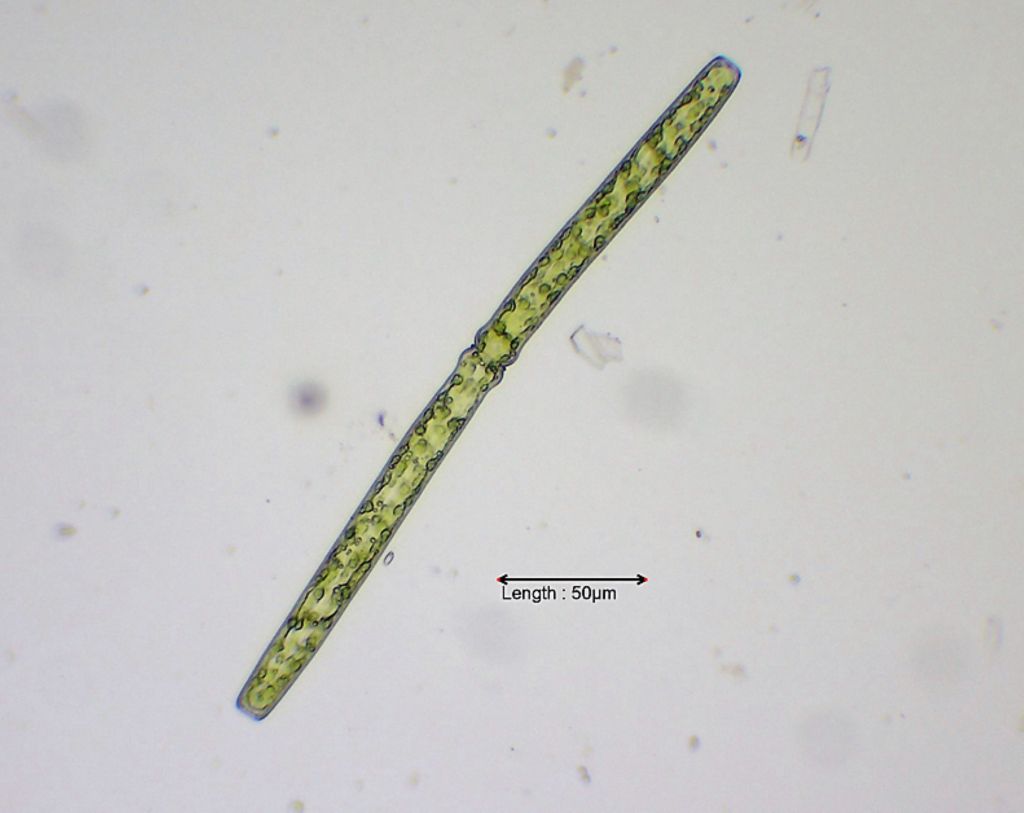 Pleurotaenium ehrenbergii