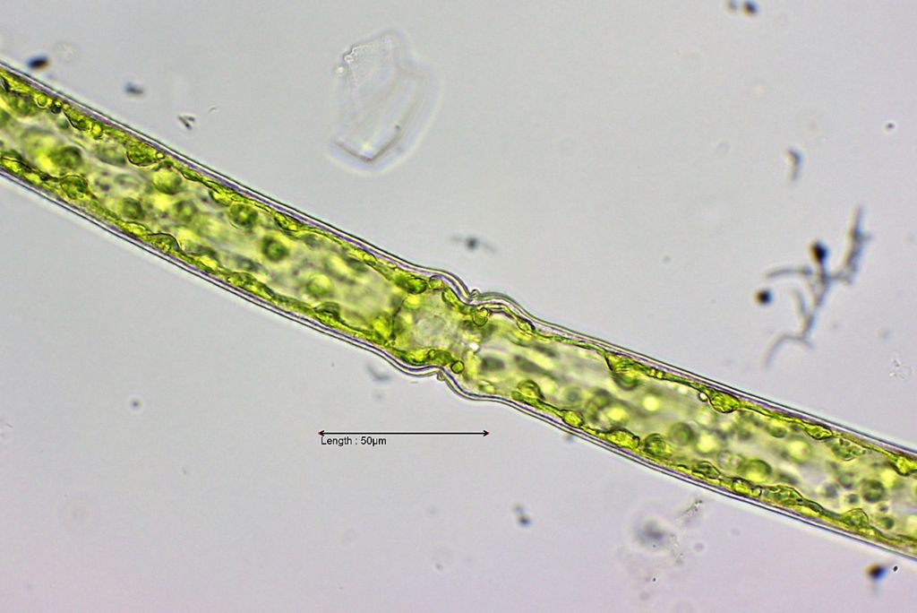 Pleurotaenium ehrenbergii middle