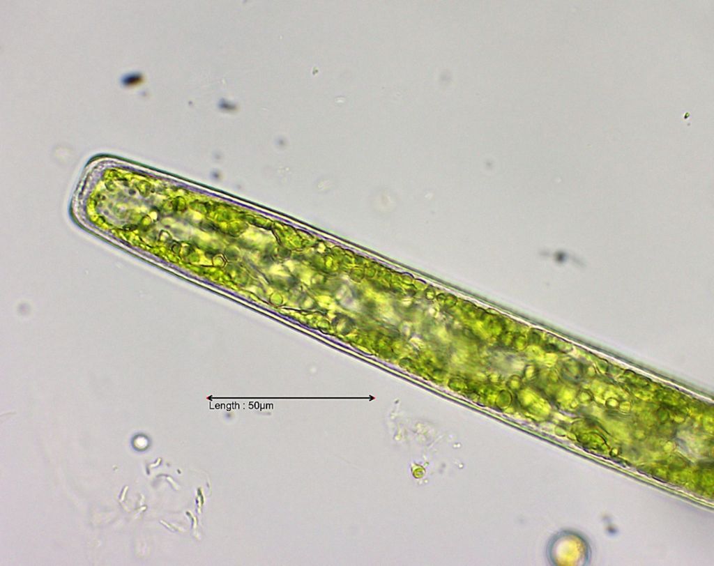 Pleurotaenium ehrenbergii top