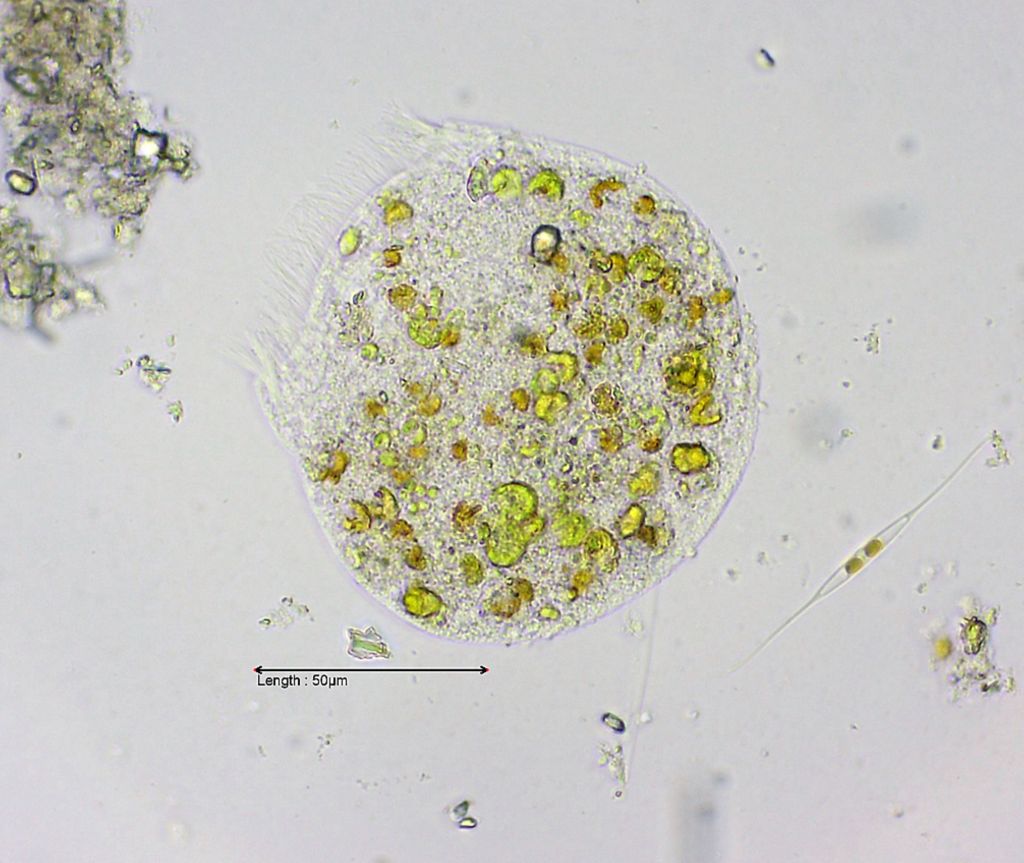unidentified ciliate