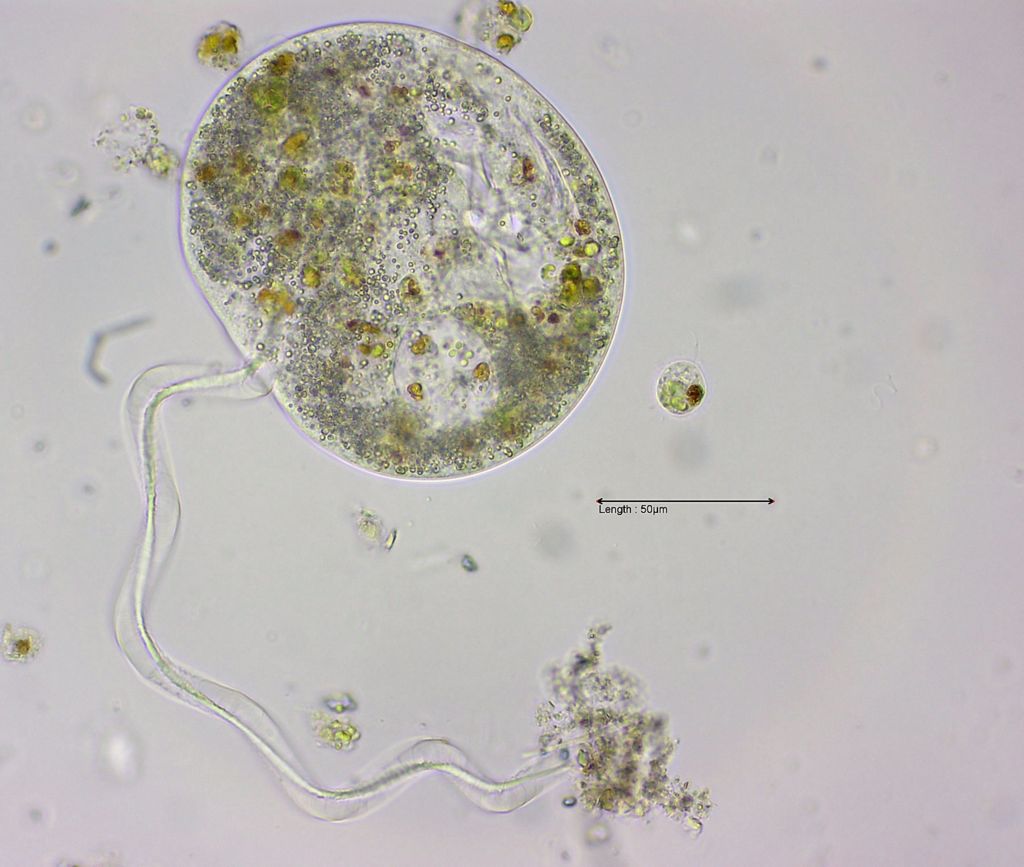 Vorticella or Epistylis????