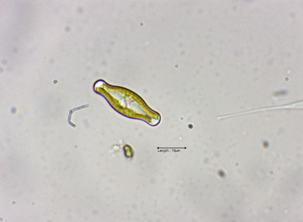 Navicula schadei
http://galerie.sinicearasy.cz/galerie/chromophyta/bacillariophyceae/navicula?image_id=11532