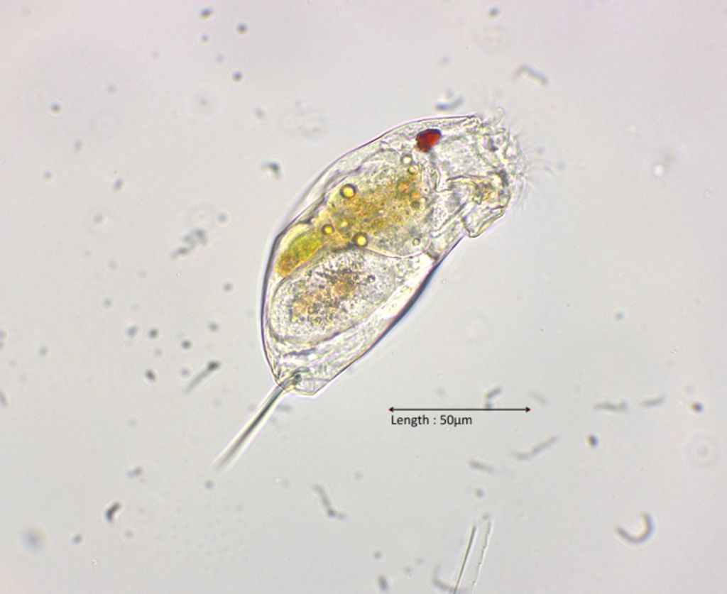 Cephalodella cf. hoodi