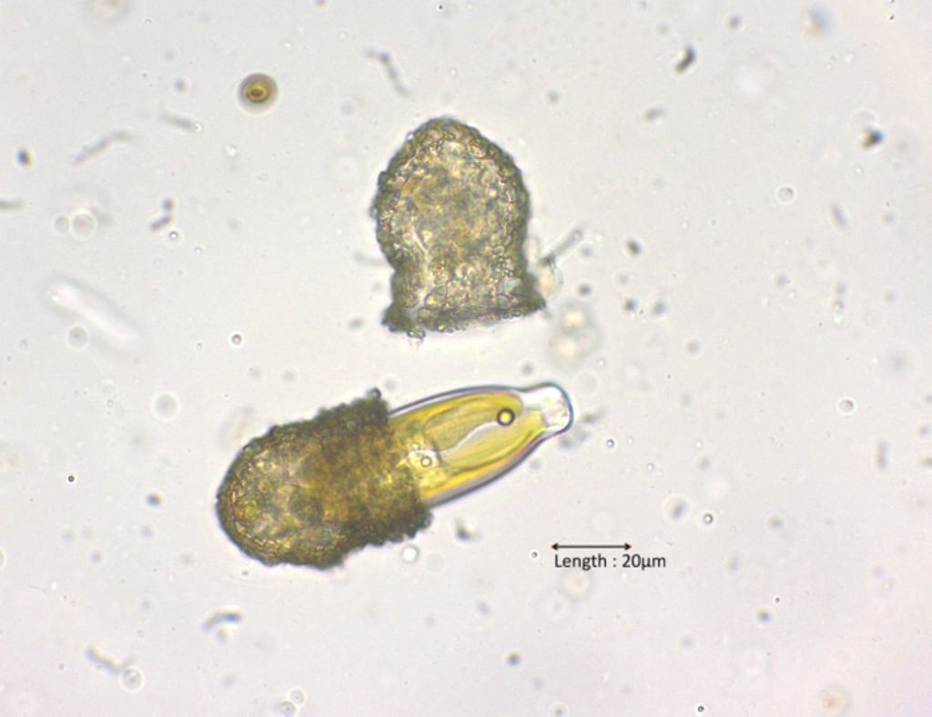 Codonella eats Caloneis