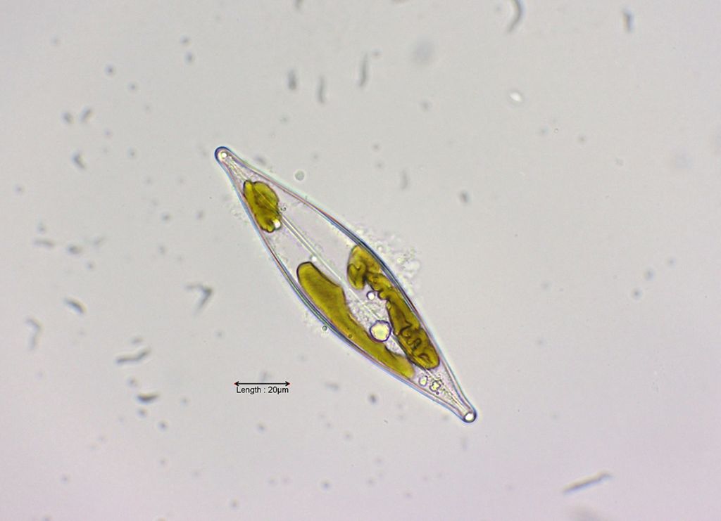 Craticula cuspidata
Navicula cuspidata