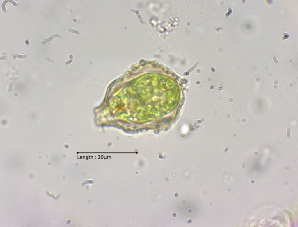 Strombomonas cf. verrucosa