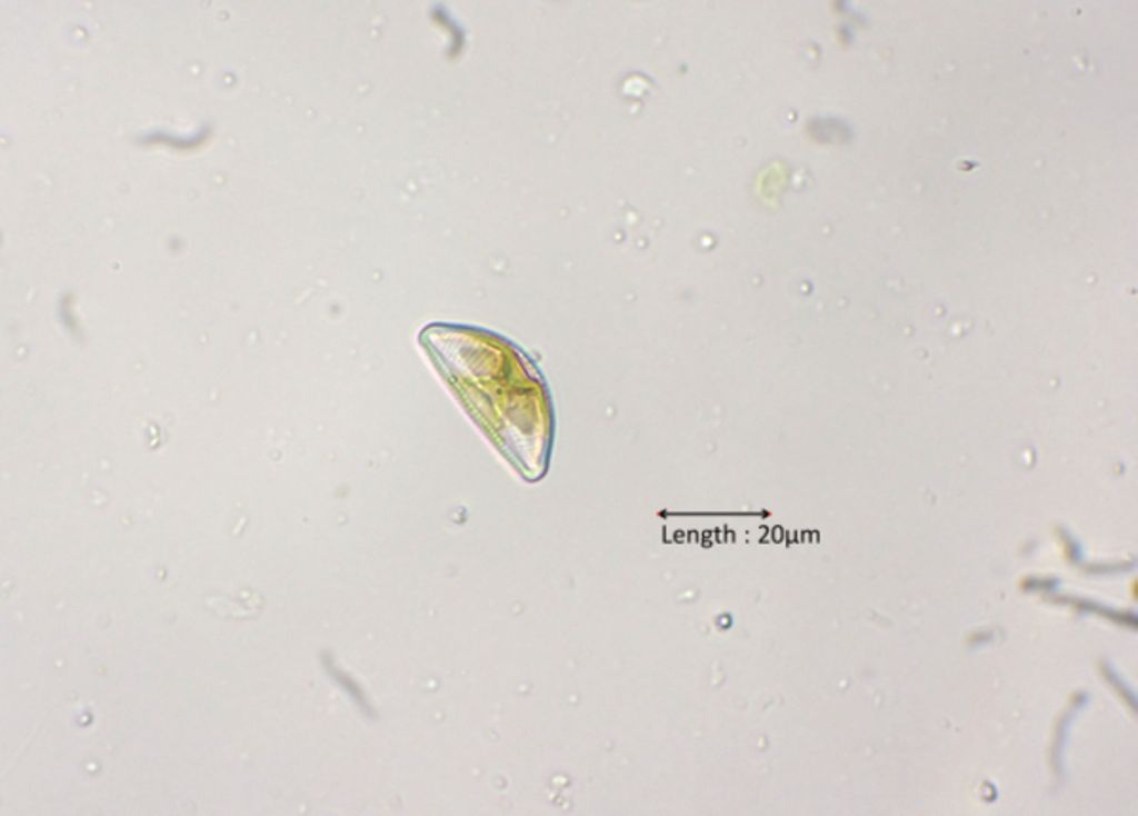 Cymbella cf. prostrata