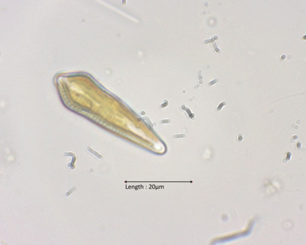 Gomphonema acuminatum