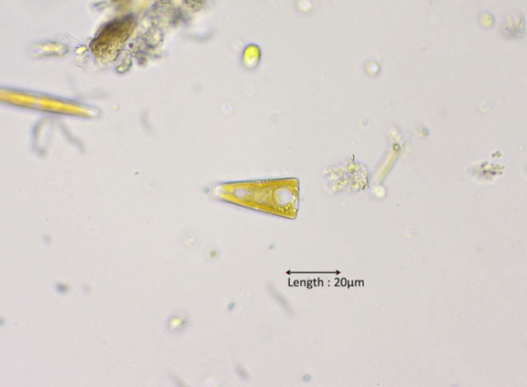 Gomphonema constrictum girdle view