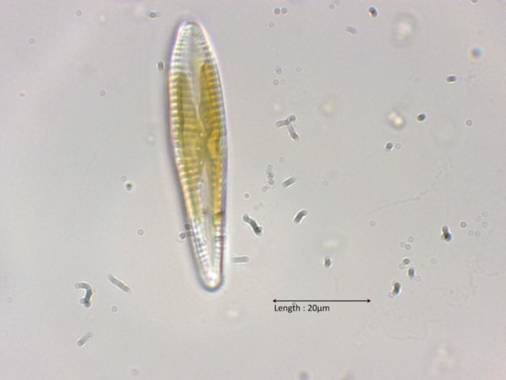 Gomphonema olivaceum
