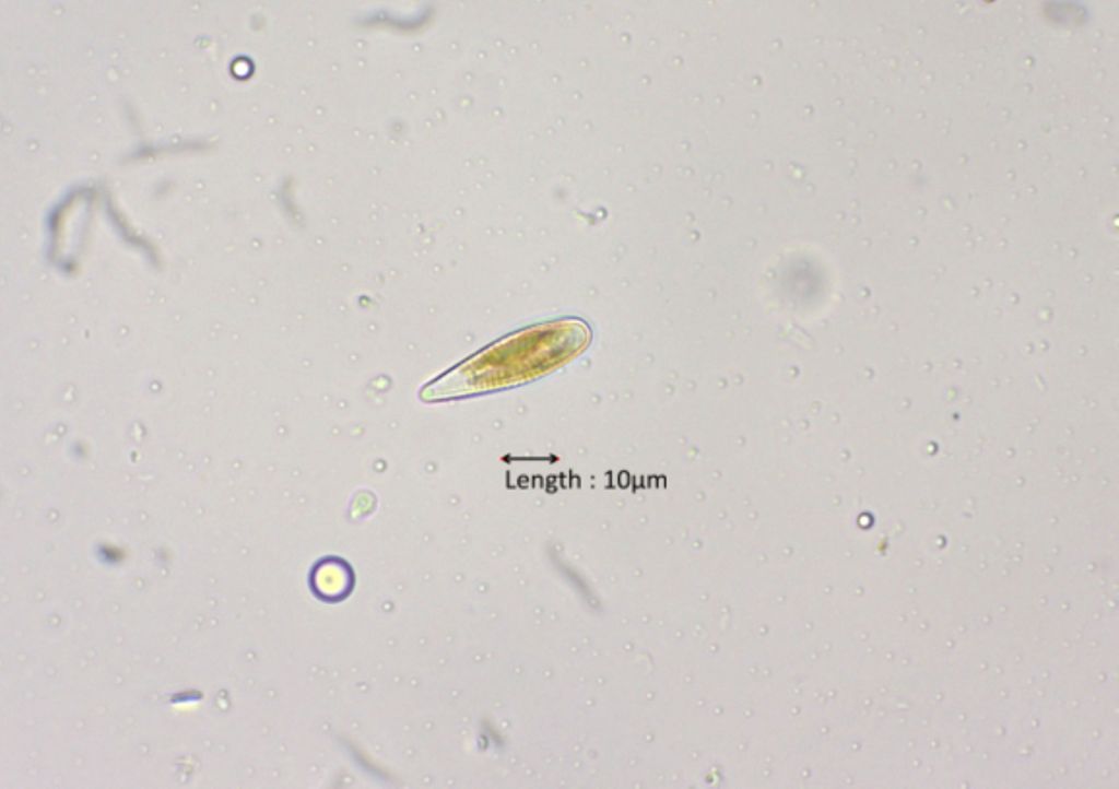 Gomphonema olivaceum