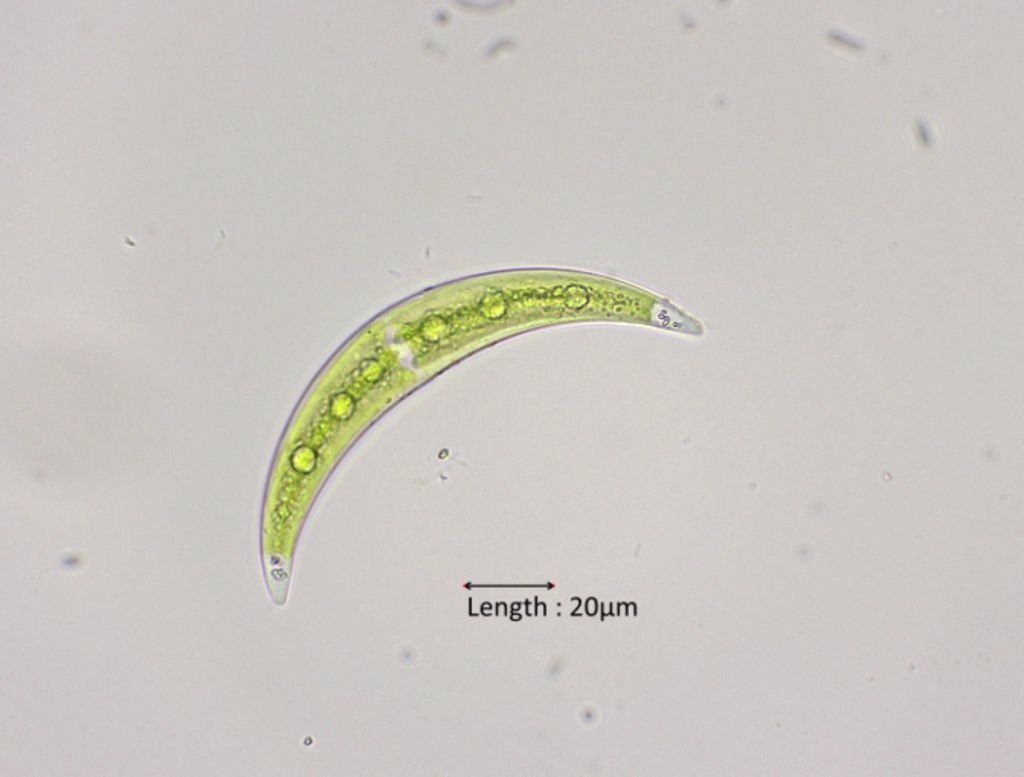 Closterium tumidulum