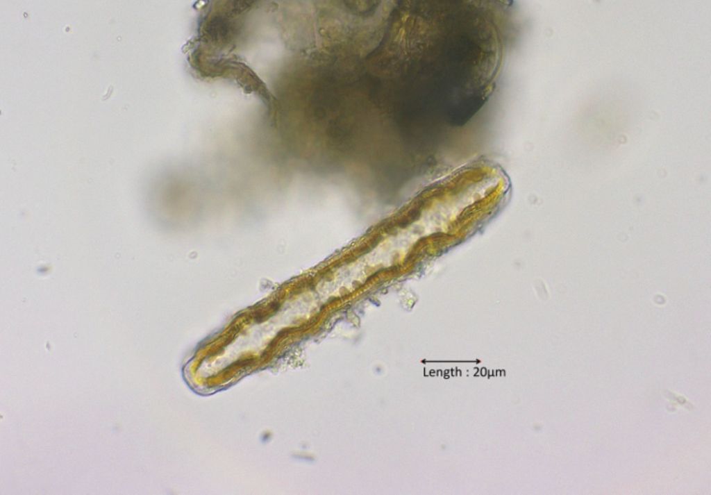 Cymatopleura solea girdle view