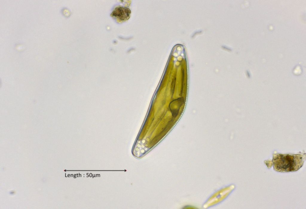 Cymbella cf. cistula