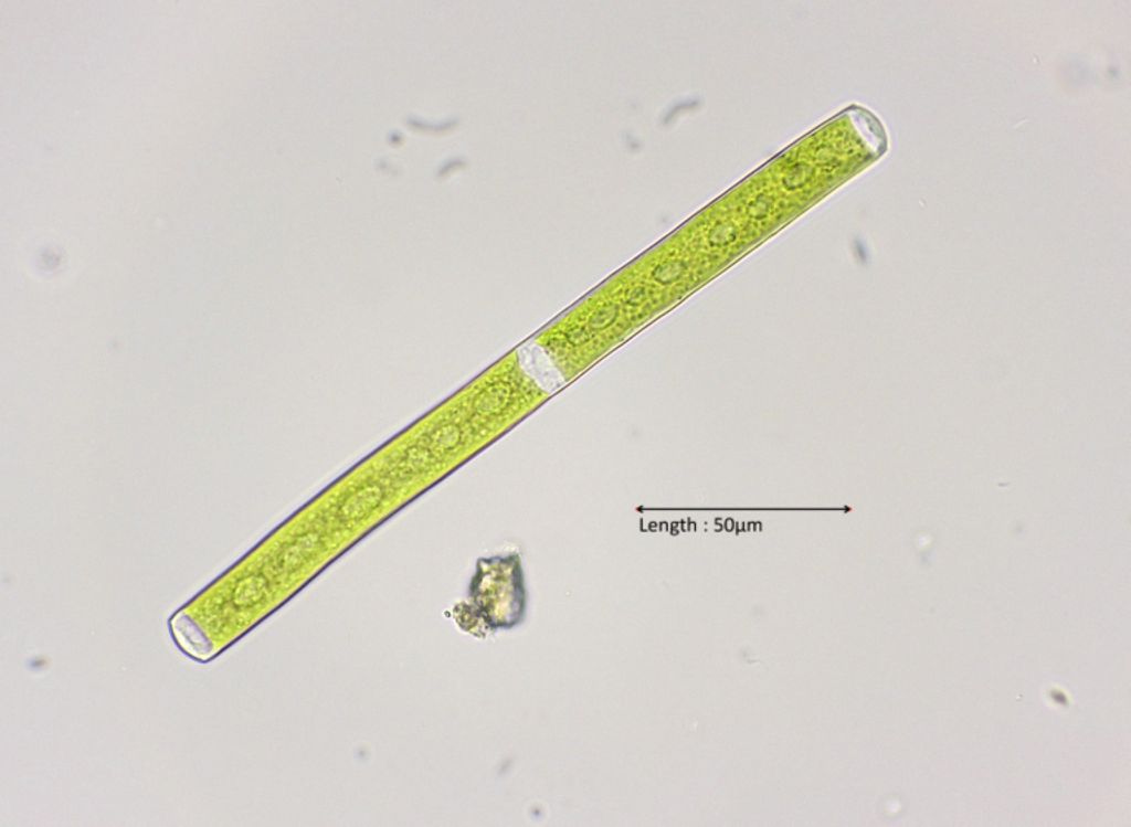 Gonatozygon kinahanii 40x