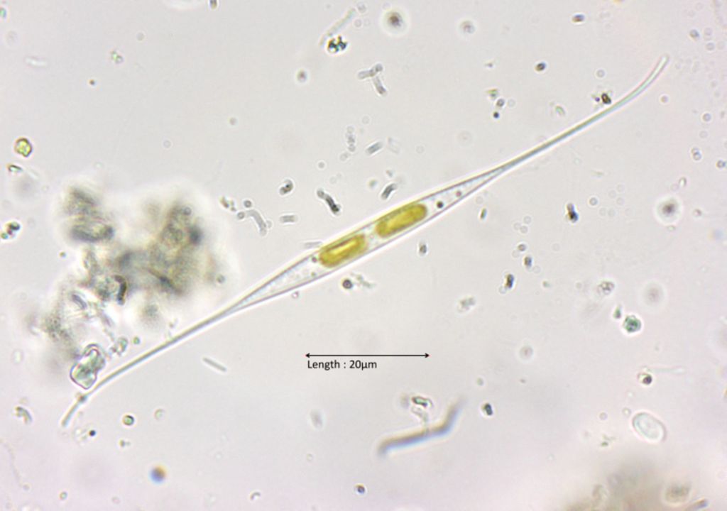 Nitzschia cf. longissima