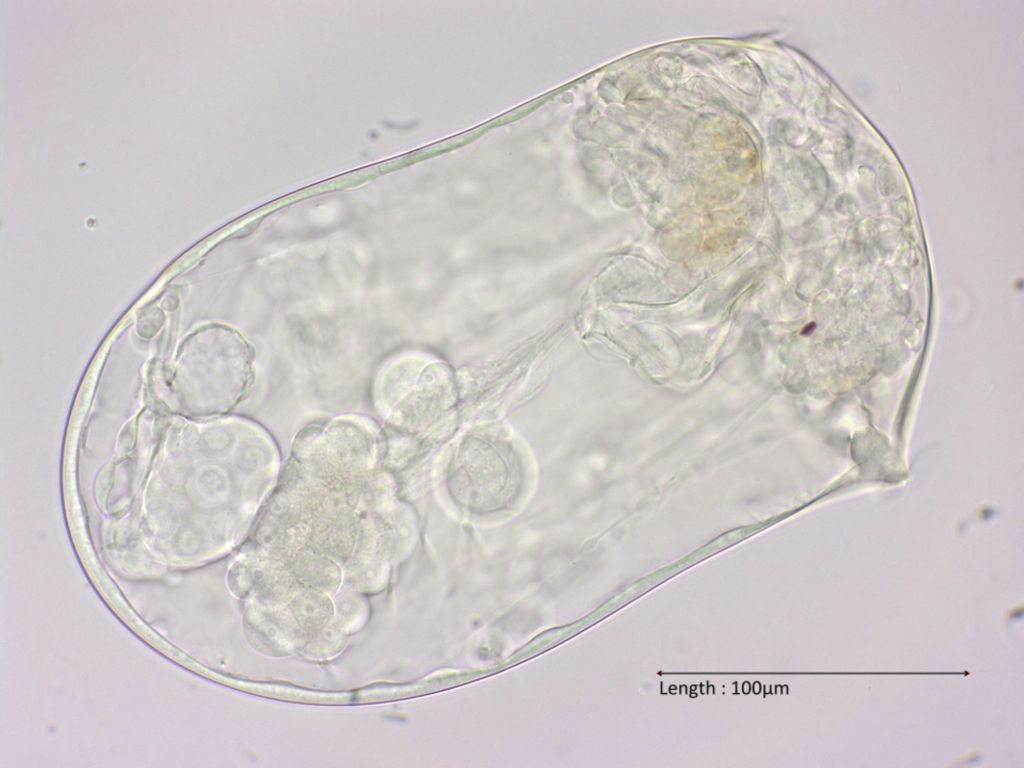Asplanchna spec