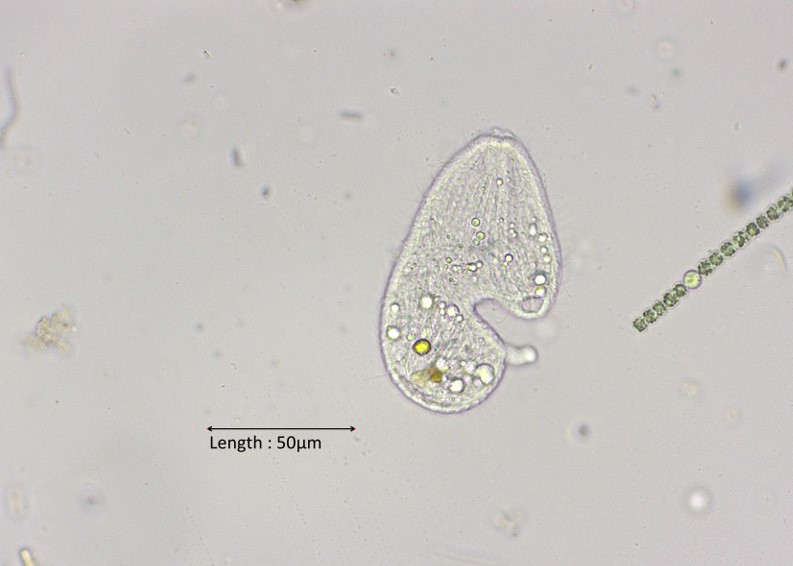 Colpoda cucullus