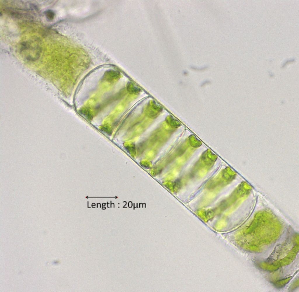 Spirogyra spec