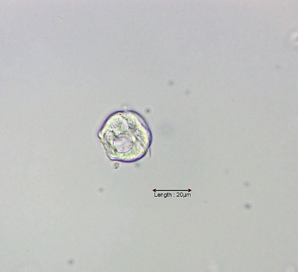 Vorticella spec