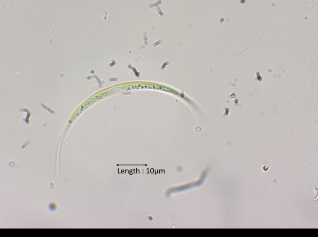 Closterium acutum cf. variabile