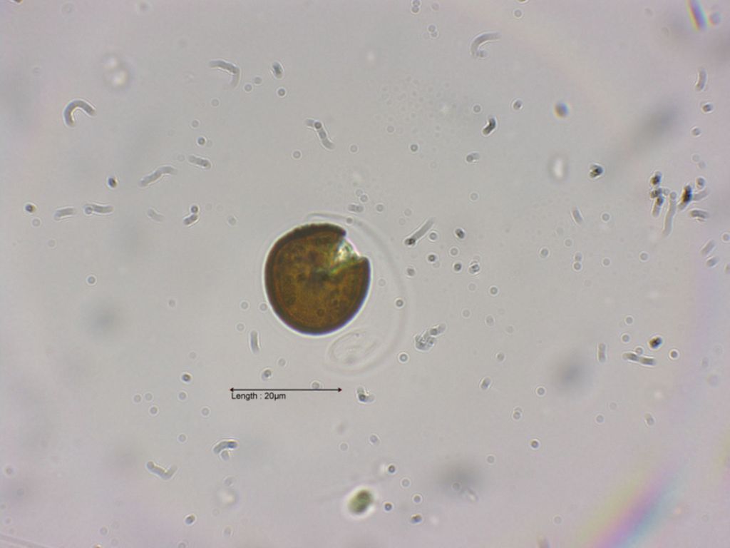 Trachelomonas psec starts creeping out of its lorica