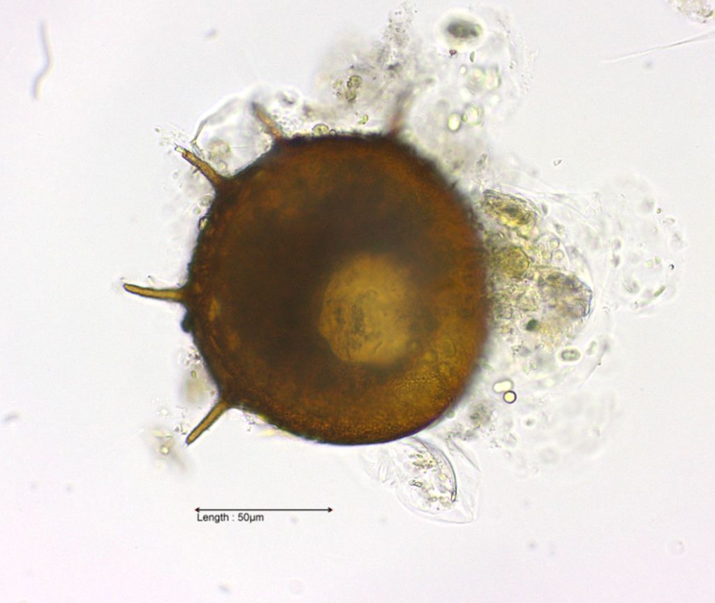 Centropyxis aculeata 40x